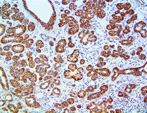 beta catenin antibody|Beta.